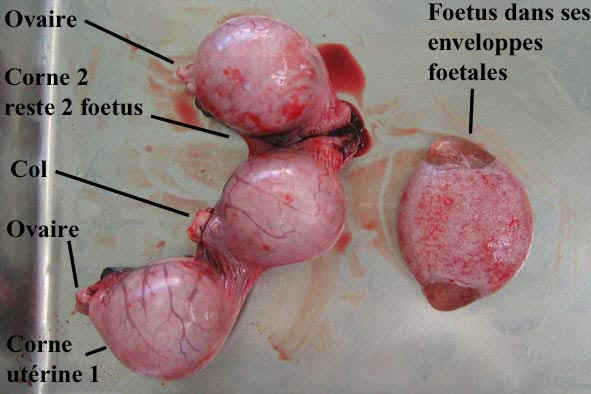 4-5sem_uterus_ampoule_1bis